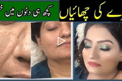 How To Cover Up Freckles | Easy Makeup Steps || Pigmentation cover base || Bonus Tip || (Part 2)